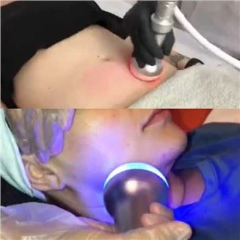 Kryotherapy slimming Machine