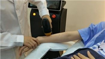 Laser díóða ljósleiðara háreyðingarvél