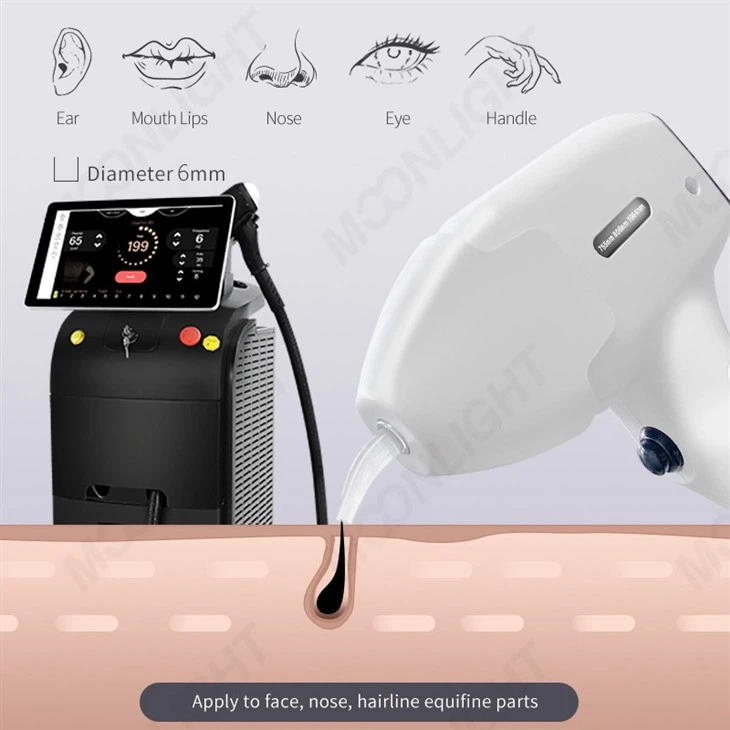Diode Laser háreyðingarvélar Kostir