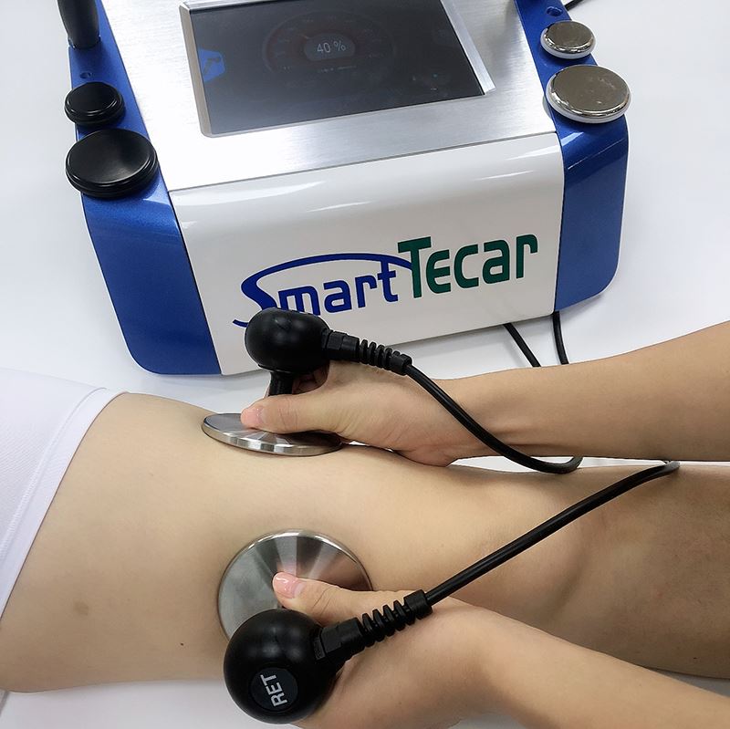 Smart Tecar sjúkraþjálfunarvél