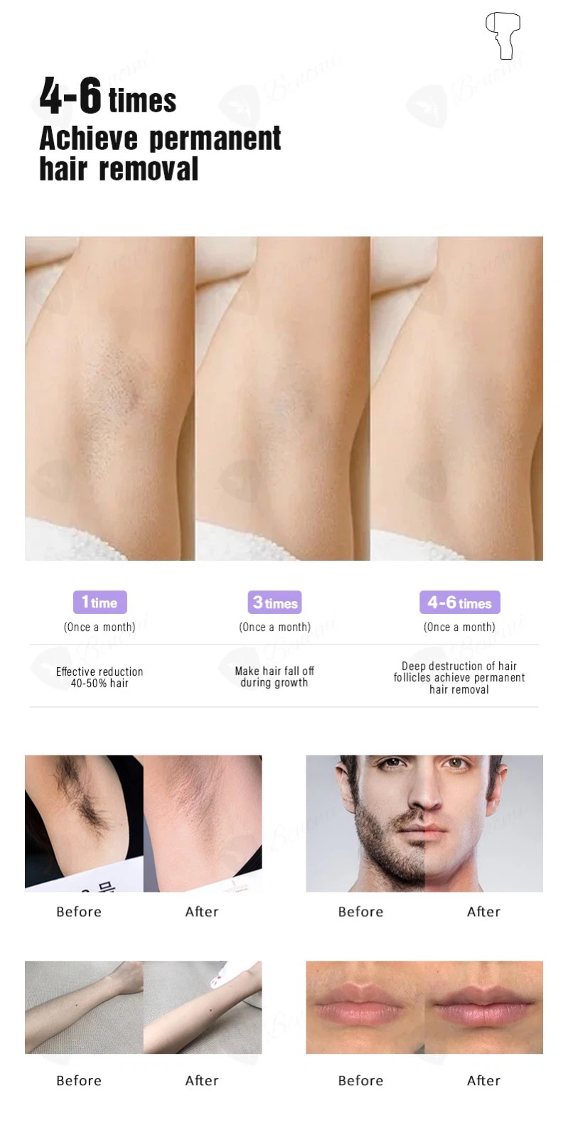 Soprano Titanium 3000W Diode Laser Hair Removal Machine price